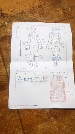 女F4團員Amy遭家暴‧驗傷單曝光認婚變 