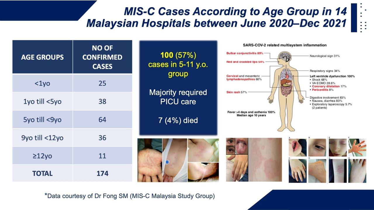 封面：儿童多系统炎症综合征（MIS-C）