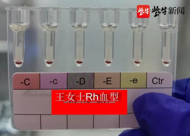 江苏发现两例全球罕见血型