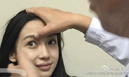 Angelababy整牙前后照被盗用 怒提告获赔逾2万	