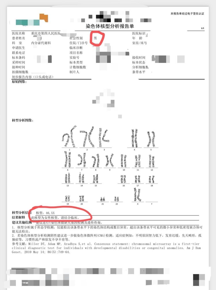 拚盤)男子婚後求子不得 一查竟是「女兒身」 醫院：性反轉罕見病