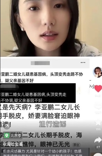  李亚鹏女儿被传患基因病 海哈金喜怒斥造谣者不配做人	