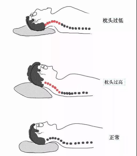 高枕并非无忧 ︱日本新研究：枕头过高可能诱发中风