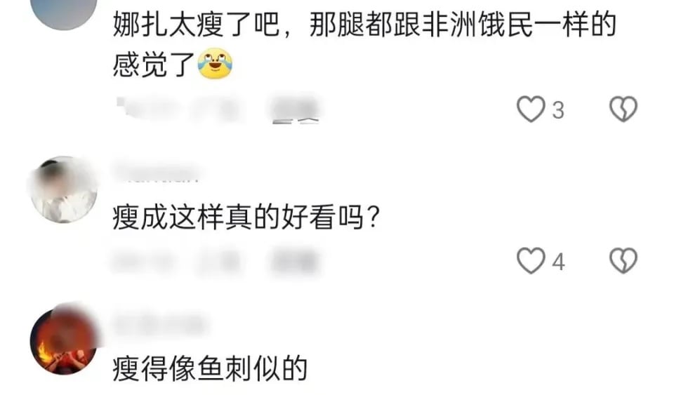 古力娜扎过瘦惊变鱼刺 娱圈病态审美惹议