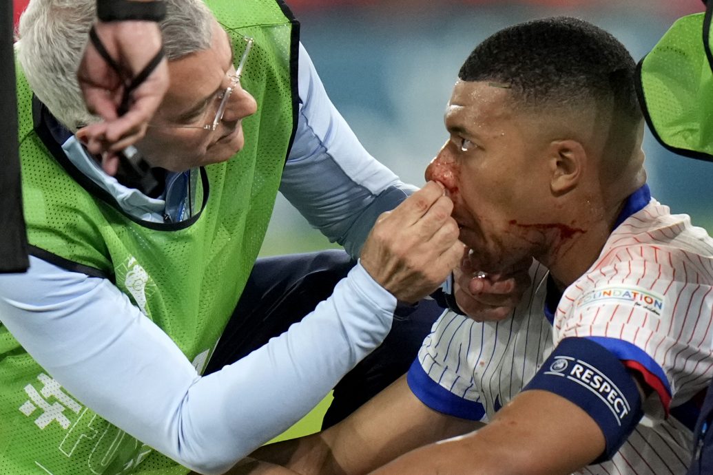 德尚|姆巴佩的鼻伤严重  欧洲杯后需动手术