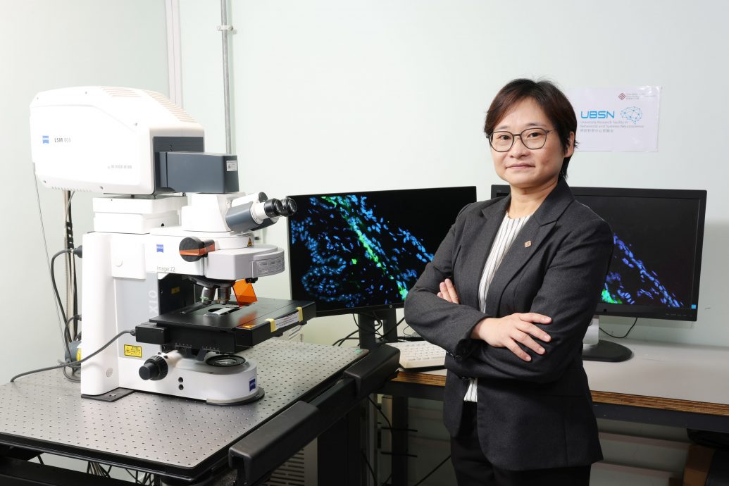 Dr Samantha Shan, Research Assistant Professor of the School of Optometry of PolyU, and her team have discovered the mechanism of intraocular pressure regulation, paving the way for novel treatment approaches for glaucoma.