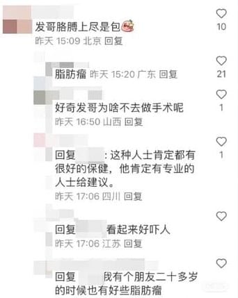 周润发手臂冒多颗肉球 网民：好吓人