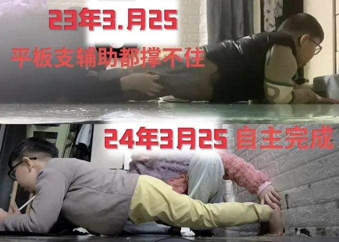 腦癱男孩邁步行走