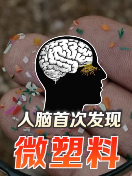 科学家首次在人脑发现微塑料 若看摄入量 大马会是高危国？