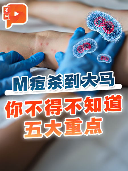 M痘杀到大马 你必须知道的五大重点