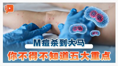 M痘杀到大马 你必须知道的五大重点