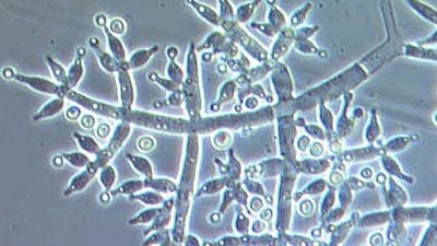 研究：生長率孢子產量較高   聲音刺激真菌生長