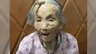 107歲老人額頭長角！網驚呼是長壽角”　醫揭真相：這是病