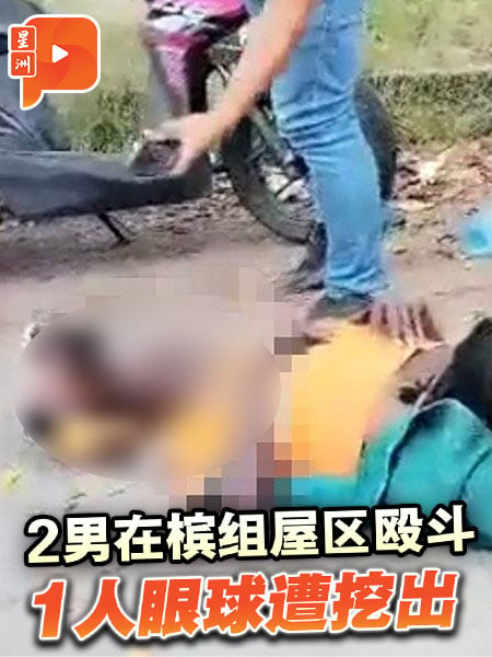 2男在檳組屋區毆鬥 1人眼球遭對方挖出