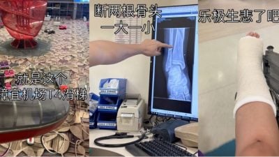 樟宜机场玩滑梯乐极生悲 马女两根脚骨断