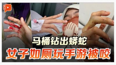 上厕所玩手游 蟒蛇钻出马桶 咬伤女子大腿