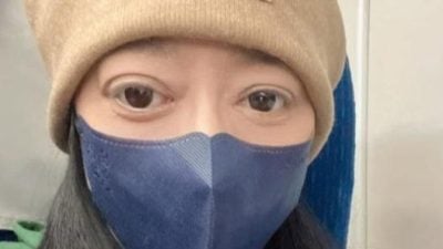 与歌神合唱成名女歌手染怪病 几近毁容崩溃：怎么活